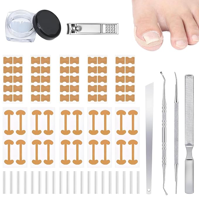 Ingrown Toenail Corrector Set with Correction Strips, Ingrown Toenail Removal Kit, Professional Toenail Tool Kit Includes Breathable Toenail Strips, Ingrown Toenails Pedicure Tool Set for Home Use