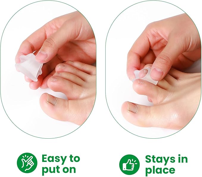 Bukihome Hammertoe Corrector - 6 Pack Toe Straightener to Curled Toes, Broken toe, Bunion Corrector for Women and Men, Medium Size (Clear)