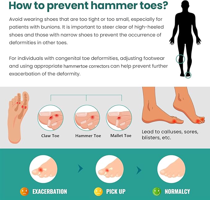 Welnove Hammertoe Corrector - 6 Pack Toe Splints - Soft Gel Toe Straighteners - Realign Bent, Curled, Crooked, Claw, Hammer Toes - Toe Corrector for Men and Women, Medium (Beige), FSA or HSA Eligible