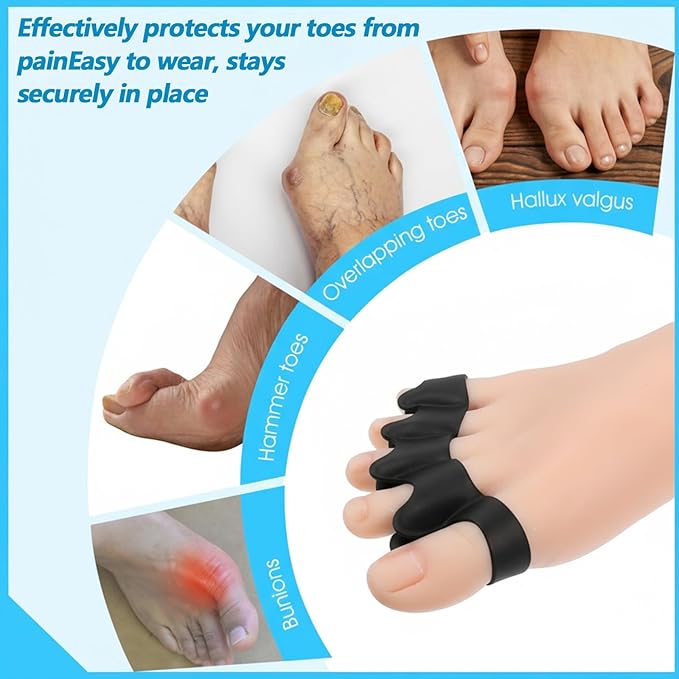 4PCS Toe Separator, Toe corrector for Women, Toe Straighteners for Curled Toes, Toe Spreader, for Toes Turned Outward, Foot Pain Relief and Foot Health (Black)