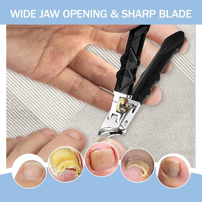 (1SET) 2025 New Orthoclip Toe Nail Clippers，New Ultra Sharp Stainless Steel Wide Jaw Opening Anti-Splash Slanted Nail Clippers of Oblique and Flat Mouth,Thick Nails, Fingernails & Toenails