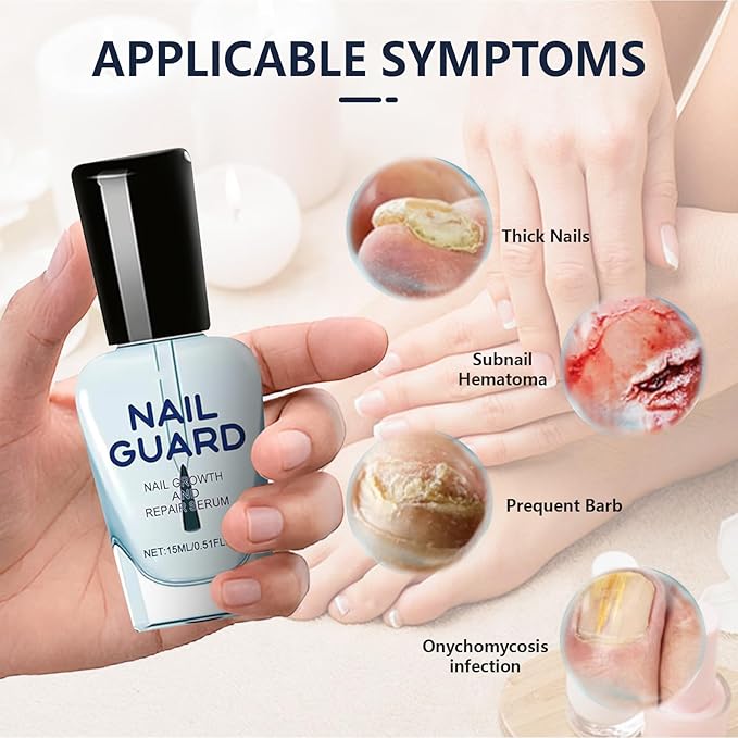 Onyxoguard Nail Growth And Repair Serum, Nail Growth and Strengthener Essence For Thin Nails And Growth, Nail Growth Serum, Onyxoguard Serum (2PCS), White