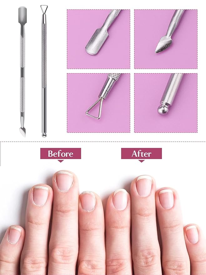 8PCS Nail Soaking Bowl Lorvain Nail Soak Tray with 6PCS Nail Polish Remover Tools Manicure Bowls with Cuticle Peeler Pusher Cutter and Nail Files Professional Nail Art Spa Tools for Salon Home (Pink)