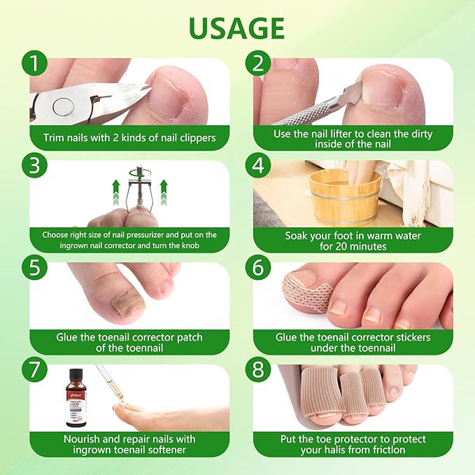 Ingrown Toenail Removal Kit - Professional Ingrown Toenail Treatment Tool Includes Ingrown Toenail Corrector Drops, Corrector Patch, Toenail Clipper, Nail File Lifter Pedicure Tools At Home