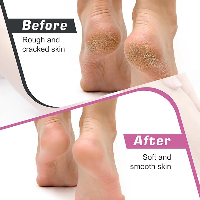 Electric Callus Remover, Foot Nail File Grinder Tool with Speed Controller and 60PCS Replacement Sandpaper Disk, Pedicure Tool Feet Scrubber for Dead Dry Crack Skin Calluses
