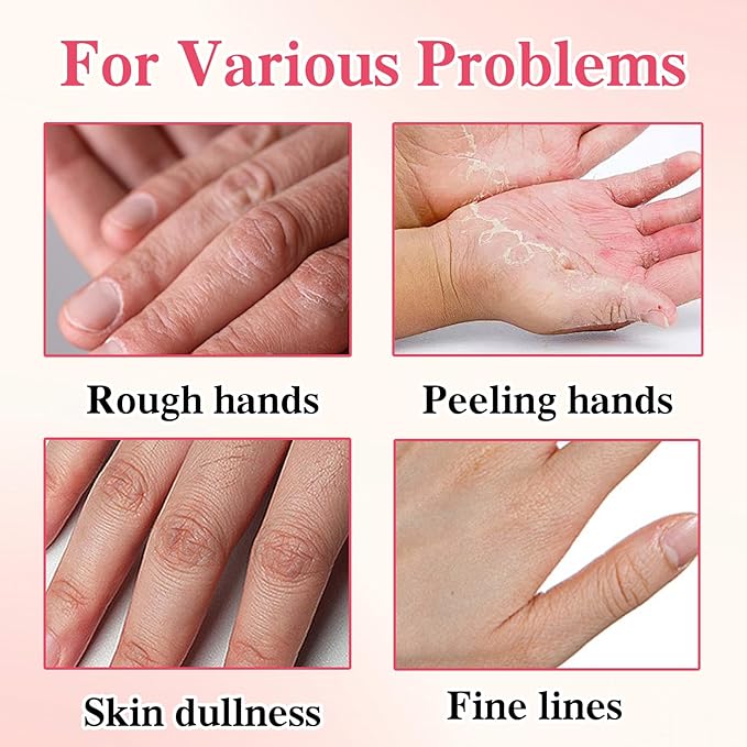 6 Pcs Hand Masks Moisturizing Glove, Hydrating Hand Mask for Dry cracked Hands, Exfoliating Collagen Gloves for Smooth Hands, Smooth Exfoliating Hand Peeling Mask