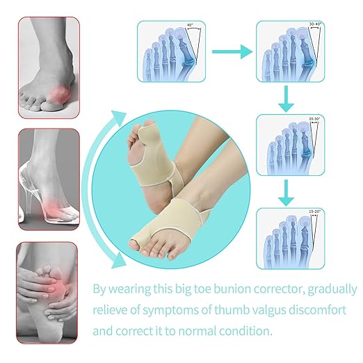 Bunion Relief Sleeves Bunion Pads Brace Cushions Toe Straightener with Silicone Gel Big Toe and Pinky Separator Spacer Hallux Valgus Relief Kit Pack (Small)