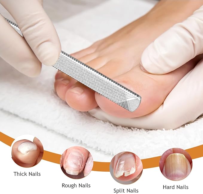 Toe Nail Files for Thick Nails,Professional Stainless Steel Nail File for Fingernails, Toenails, Scraping, Strengthening, Finger Manicure File Women Men Seniors Dogs (Small, 1, Count)