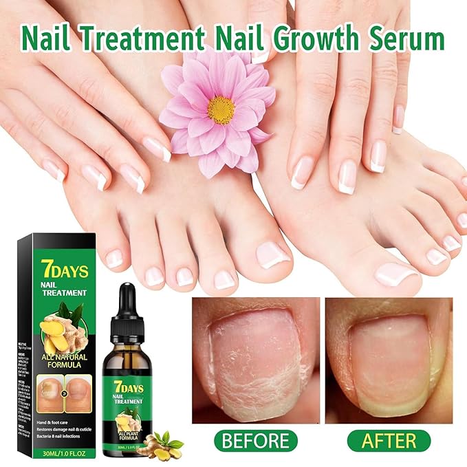 Ginger Nail Treatments, 7 Days Ginger Cuticle Care Oil for Nails for Strengthen nails & Promote Nail Growth, Natural Plant Formula（2PCS)