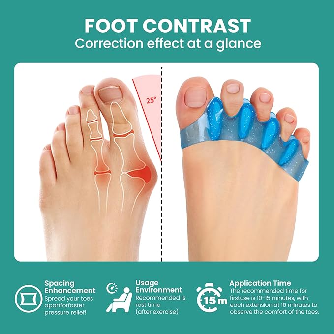 Welnove Toe Separators & Toe Spacers: Bunion Corrector for Women Men, Toe Spacers Toe Stretcher for Nighttime, Yoga Practice (8Pcs, Blue)