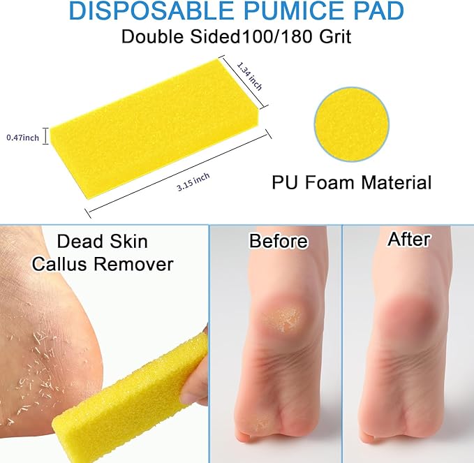 Disposable Pedicure Kit 5-in-1, 100 Counts - Nail Buffer, Pumice Pad, Nail File (100/180 Grit), Wood Stick and Toe Separators - Complete Pedicure Kit for Salon or Home Use