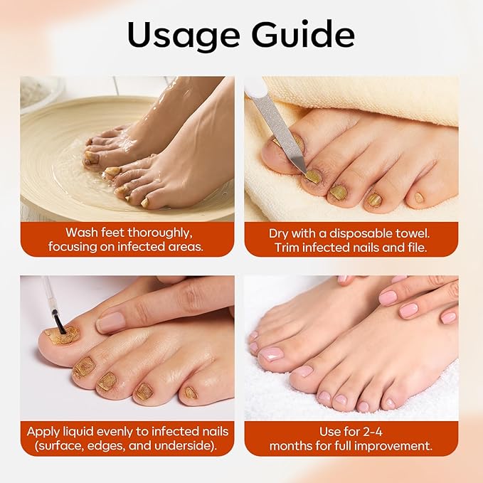 modelones Toenail Fungus Treatment Extra Strength 7days Nail Fungus Treatment for Toenail and Fingernail With Brushes Head Nail Repair for Damaged Nails Antifungal Nail Polish 30ML 1Fl Oz