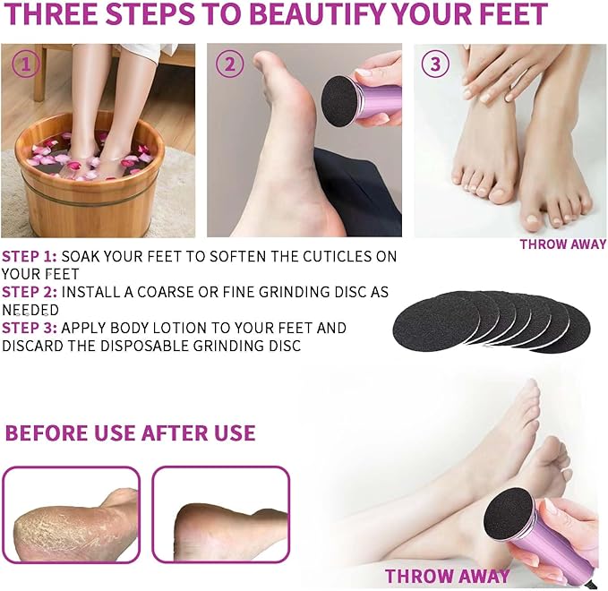 Electric Callus Remover for Feet, USB Power Supply Electric Foot File Sander Scrubber with Speed Controller 60Pcs Replacement Sandpaper Disk for Dead Skin, Cuticles