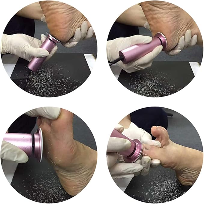 Electric Foot File Callus Remover, Professional Calluses Remover for Feet with 60pcs Sandpaper Discs, Adjustable Speed Control Pedicure Tool for Men Women Dead Dry Cracked Hard Skin