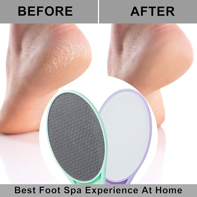 Nano Glass Foot File Callus Remover, 2 Pack Hard and Dead Skin Remover for Feet, Double Sided Foot Scrubber Pedicure Tool, Hair Eraser for Softer and Smoother Feet Hands, Green & Purple