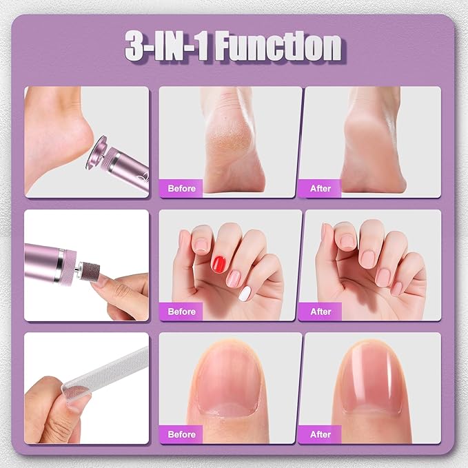 Electric Foot Callus Remover, Cordless Foot File Pedicure Tool, Foot Sander Nail Grinder with 60+10PCS Sandpapers for Dead Skin Dry Calluses, 3 in 1 Foot Scrubber & Nail File(Pink)