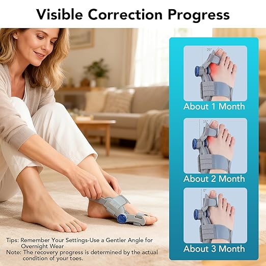 Bunion Corrector for Women Big Toe, Upgraded Adjustable Fix Bunion Relief, Men Big Toe Separator with Soft Gel Pad for Left/Right Feet Fit for All Foot Sizes (Gray 1Pcs)