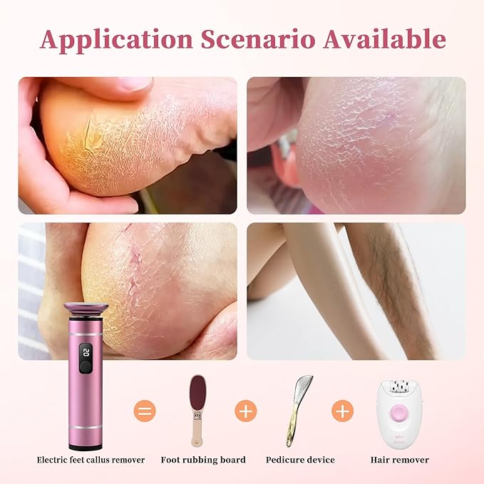 Electric Foot Callus Remover for Feet Pedicure Tools for Feet Callus Remover Foot File Electric Foot Callus Remover Pedicure Tools for Feet Foot File Callus Remover Foot Scrubber Dead Skin Remover