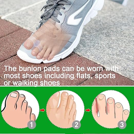 10 Pieces Bunion Corrector for Overlapping Toes, Silicone Toe Separators with 2 Loops, Big Toe Spacer Suitable for Bunion and Corrector and Spacer