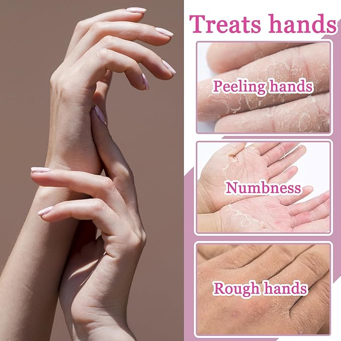 Hydrating Hand Masks, 6PCS Hand Mask Moisturizing Gloves for Men Women, Smooth Long Lasting Soft Exfoliating Hand Peeling Spa Mask Moisturizer Beauty Gift Set for Dry Cracked Rough Dull Hands（L)