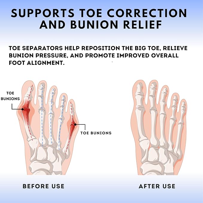 ZB.ONE Toe Separators/Toe Spacers for Women & Men, Stretchy & Flexible Toe Separator for Pedicure and Comfort, Silicon Toe Separator for Bunion Relief, Toe Spacers for Athletic Mobility, White 2 Pairs