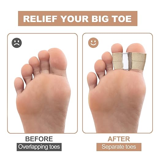 6 Pack Big Toe Separators, Gel Bunion Corrector with Elastic Band for Overlapping Toe Silicone Toe Spacers for Hallux Bunion Relief