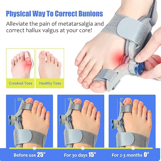 Adjustable Bunion Corrector for Women & Men Big Toe – The toe straightener Brace designed to relieve bunion discomfort – Built-in Night Bunion Correctors for Resting Comfort and Hallux Valgus Support