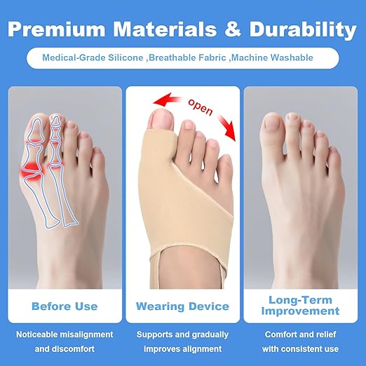 2-Pack Bunion Corrector for Women & Men | Big Toe Straightener Splint with Silicone Spacers | Relieves Hallux Valgus, Bunion Pain & Bursitis | Day & Night Use