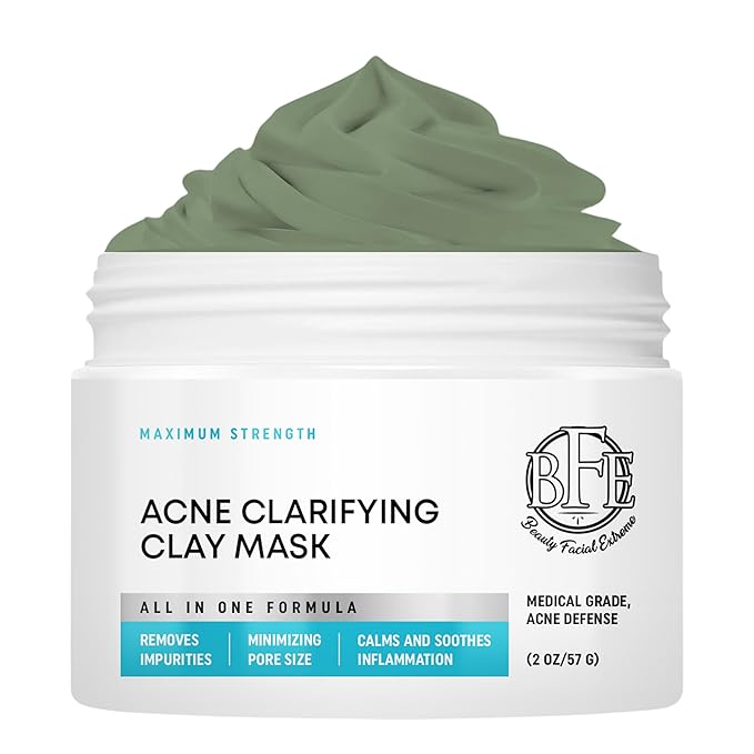 Acne Treatment Clay Mask- Clears Away Clogged Pores, Blackhead & Whitehead Pimples, Blemishes, Scars & Oily Skin for Face & Body. Ingredients Including Sulfur, Bentonite, Kaolin & Jojoba Oil.