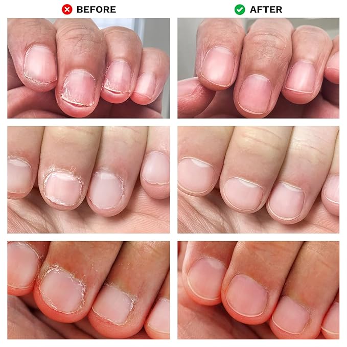 Nails Spray Fast-Drying Nail Care Moisturizer with No Odor Formula for Men & Women, Safe Mild Ingredients, 30ml/1fl oz