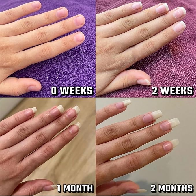 Radiant Nail Growth Oil, Nail Strengthener, Cuticle Oil for Nails, For Moisturize Strengthen Nail Care Oil, Finger Edge Manicure Nourishing Pen, Anti-hangbnail removal, Nail Skin Edge Care