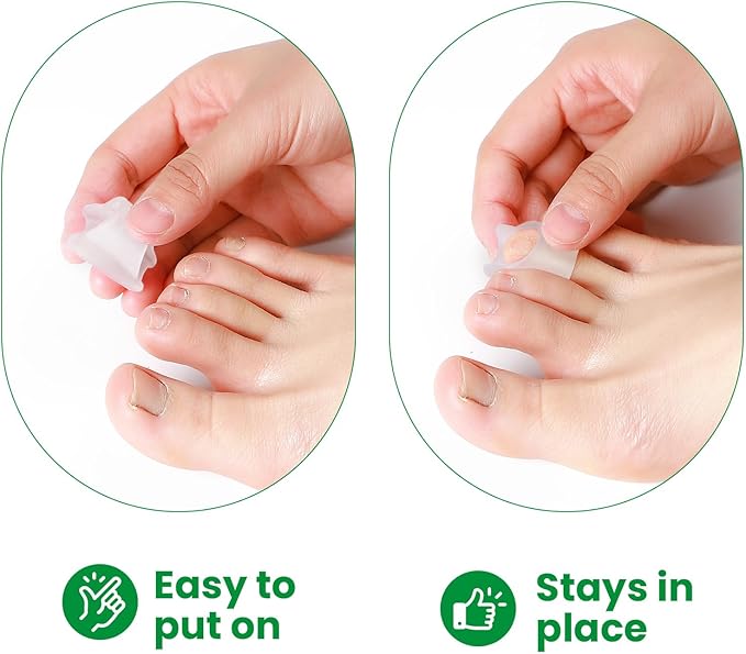 Bukihome Hammertoe Corrector - 6 Pack Toe Straightener to Curled Toes, Broken toe, Bunion Corrector for Women and Men, Small Size (Clear)