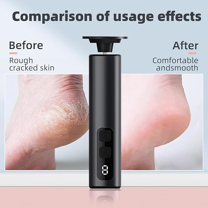 Electric Callus Remover for Feet, 9 Speed Rechargeable Pedicure Tools for Feet, Callous Remover Tool for Remove Cracked Heels and Feet Scrubber Dead Skin, Replaceable Sandpaper Discs, Battery Display