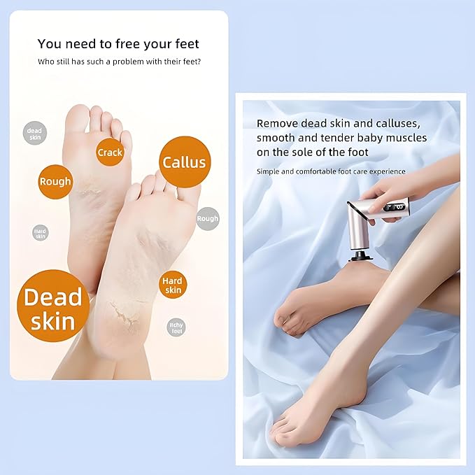 Foldable Electric Foot Callus Remover, Foot Files, 9-Speed Foot Sander Pedicure Tools for Feet Dead Skin with Sandpaper Disk and Nail Care（Rose Gold）