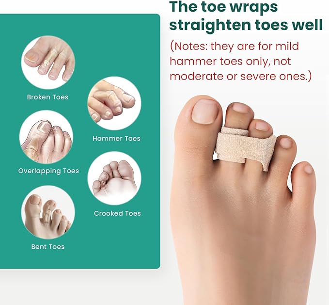 Welnove Hammer Toe Straightener - 8 Pack Broken Toe Wraps - Hammer Toe Corrector for Women - Toe Splints for Crooked Toes, Curled Toes, Bent Toes - (Large, Beige)