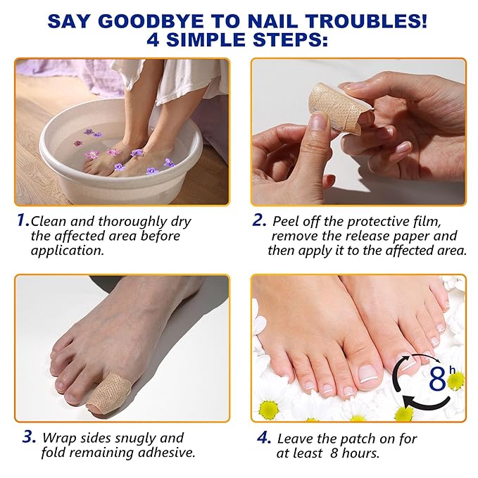 Nail TreatmentFungal Nail Patches For Toenails 32patches, Restore The Nails’ Natural Strength And Clarity.