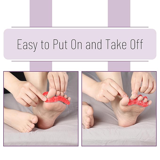 Dr. JK- ToePal Gel Toe Separator, 2 Pairs, Toe Spacers, Bunion Corrector, Christmas Gifts