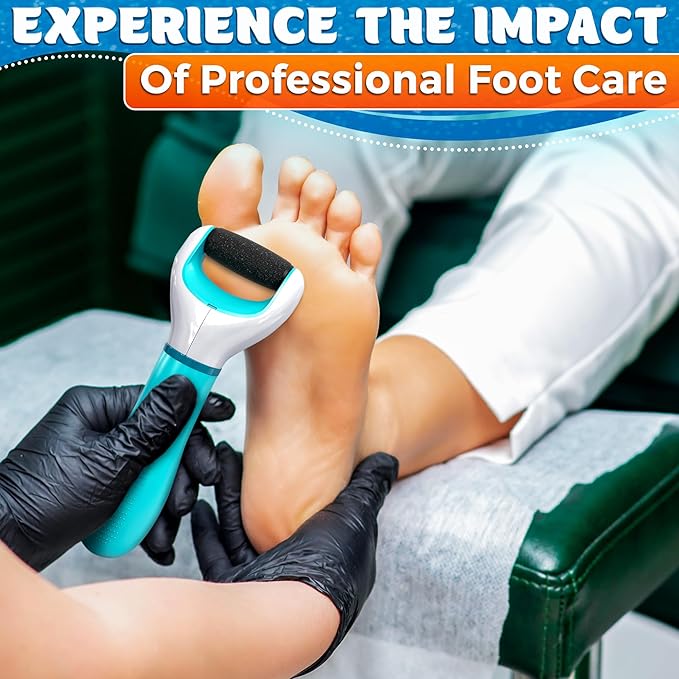 Rechargeable Electric Foot Callus Remover Tool – High-Speed 2800 RPM Electric Foot Sander Callus Remover with Replaceable Roller – Compact & Easy Maintenance, Up to 1-Hour Runtime for Smooth Feet