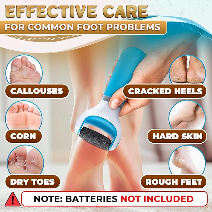 Foot Callus Remover Tool | Batteries Not Included – High-Speed Foot Grinder with Easy-to-Replace Roller – On-The-Go Electric Callus Remover for Feet | Pedicure Tools for Feet Smoothing