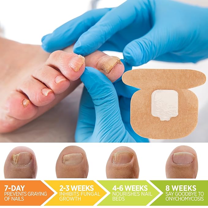 Toenail Fungus Treatment Extra Strength: (Medium) 64 Nighttime Hydrogel Patches for Overnight Repair - Visible Results in 8 Hours - Fungal Nail Patches for Toenail Fungus