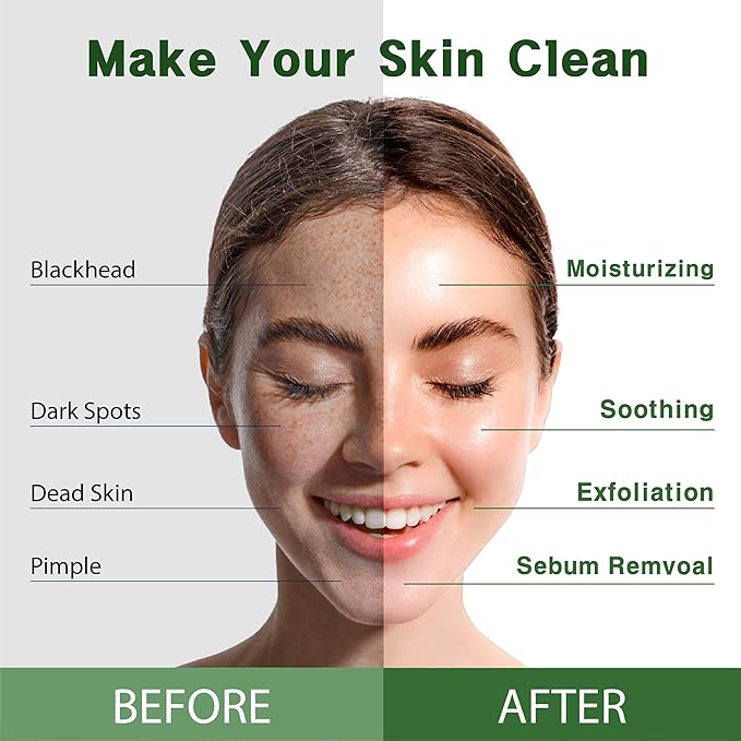 Purederm Hemp Seed Essence Mask (12 Pack) – Hemp Seed Oil, Collagen, and Vitamin E Effectively, Moisturize and Soothe the Skin