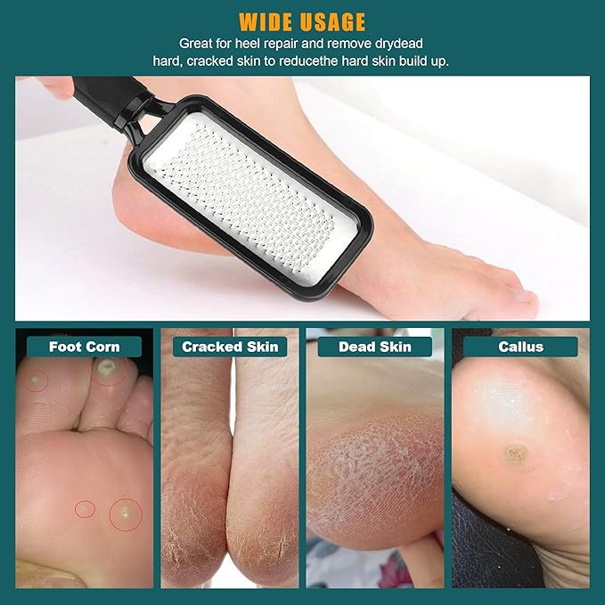 2 Pcs Foot Files Callus Remover, Stainless Steel Professional Pedicure Foot Rasp Scrubber Foot Care Tools to Removes Hard Skin Corns for Dry and Wet Fee