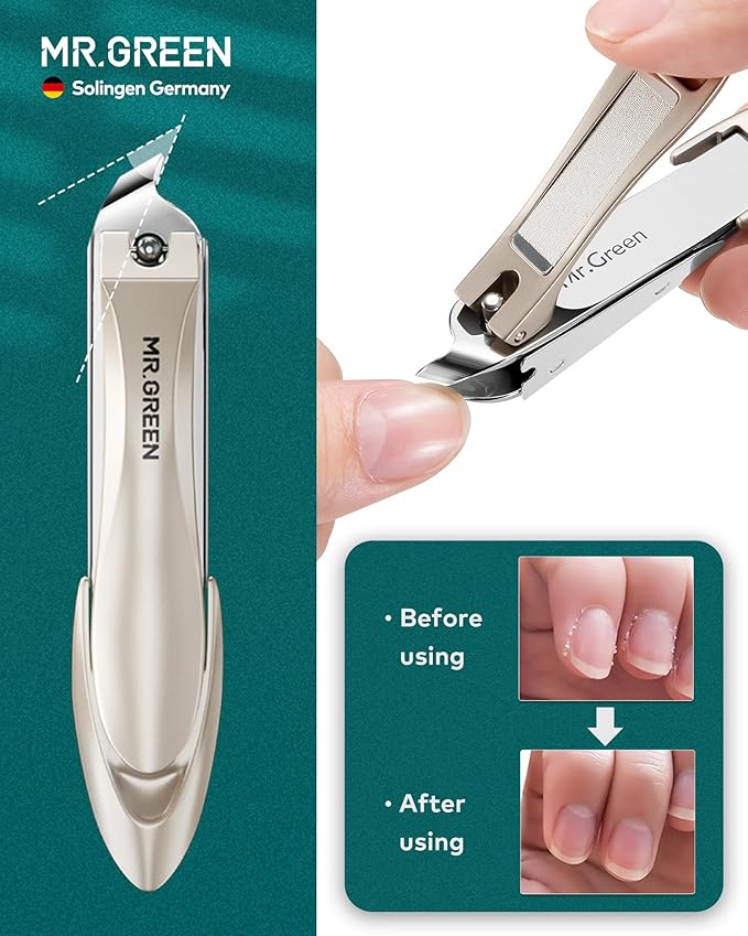 MR.GREEN Nail Clippers, Upgraded Anti-Splash Nail Clipper Set with Nail File and Tweezers & Catcher, Professional Practical Manicure Nail Care Kit with Exquisite Leather Case for Men & Women