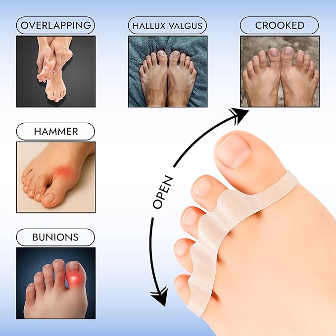 ZB.ONE Toe Separators/Toe Spacers for Women & Men, Stretchy & Flexible Toe Separator for Pedicure and Comfort, Silicon Toe Separator for Bunion Relief, Toe Spacers for Athletic Mobility, White 2 Pairs
