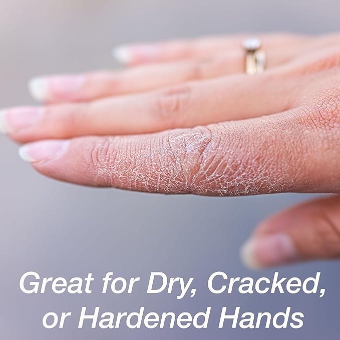 Gel Spa Moisturizing Gloves - 1 Pair Spa Gloves Infused with Essential Oils to Soften Skin & Lock in Moisture | Gel Gloves for Dry, Cracked Hands
