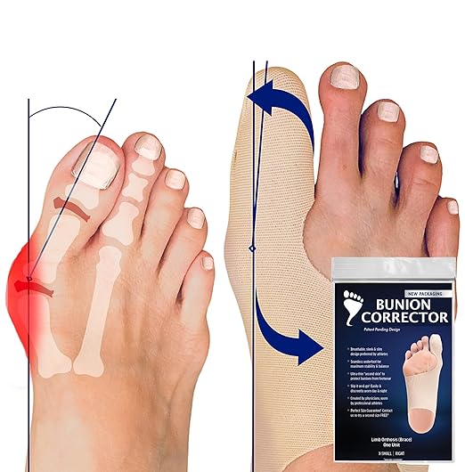 Bunion Corrector for Women Big Toe, Men too. Ultra-Thin Big Toe Straightener Socks. Correction While You Walk. Flexible & Comfortable Splint That Fits Inside All Shoes. Small-Right