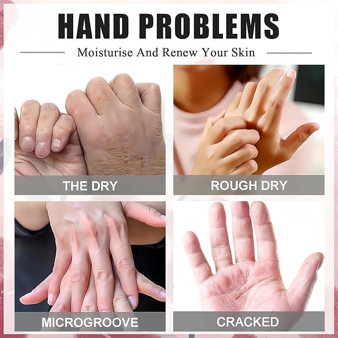 Roses & Milk Hand Repair Gloves, 5 Pairs Hydrating Hand Masks for Dry Cracked Hands, Moisturizing & Softening Gloves for Women & Men, Nourishing Hand Spa Treatment