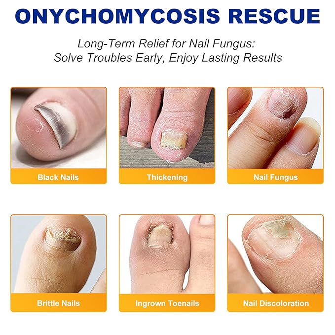 Nail TreatmentFungal Nail Patches For Toenails 32patches, Restore The Nails’ Natural Strength And Clarity.