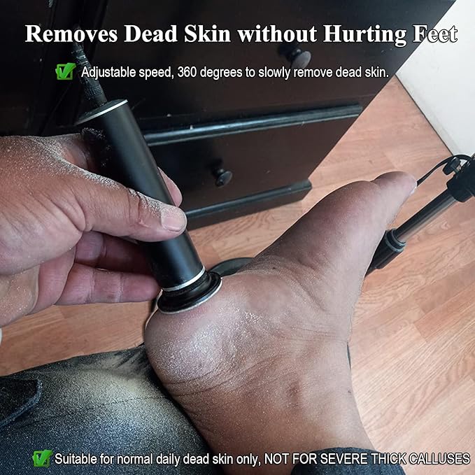 Electric Callus Remover Foot Scrubber, Adjustable Speeds Electric Foot File Sander Grinder Pedicure Tools for Feet Dead Skin Remover with 60 Replaceable Sandpaper Discs, Black