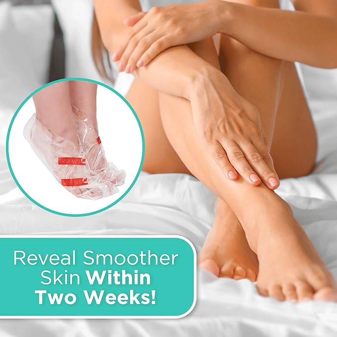 DERMORA Foot Peel Mask | Skin Exfoliating Foot Masks | Dry, Cracked Feet, Callus, Dead Skin Remover | Baby Soft Feet | Original Scent | Pack of 4 | Regular